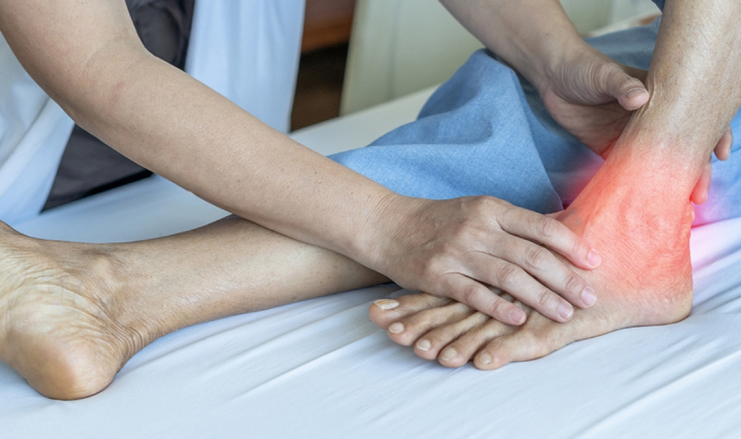 8 Common Signs You Have Experienced an Achilles Tendon Injury