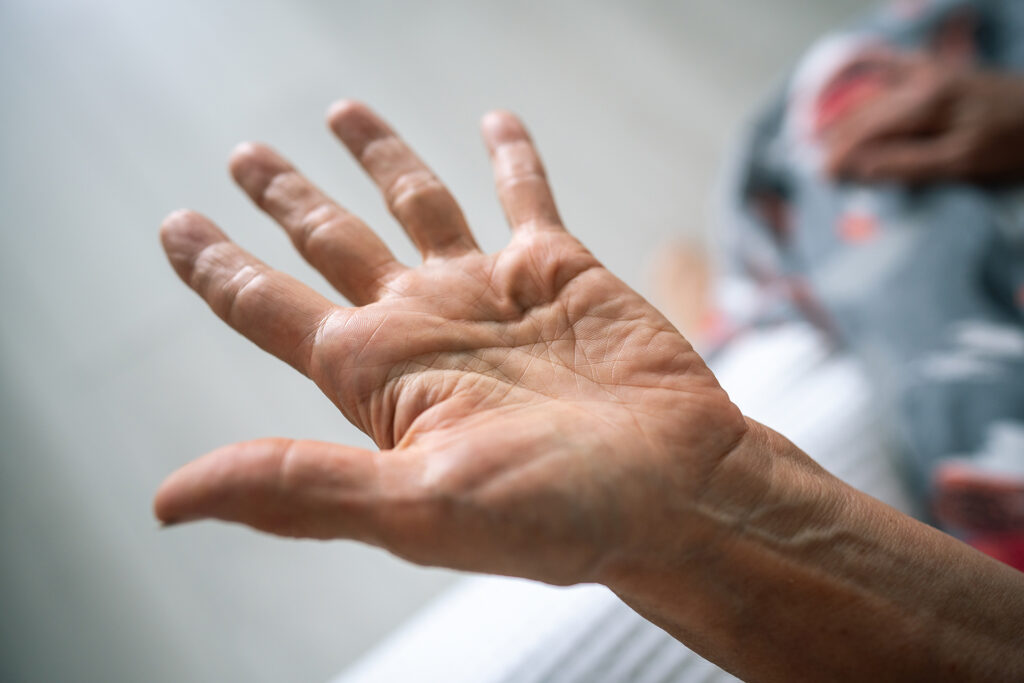 Close-up of hand tremor, one of the earliest symptoms of Parkinson’s disease
